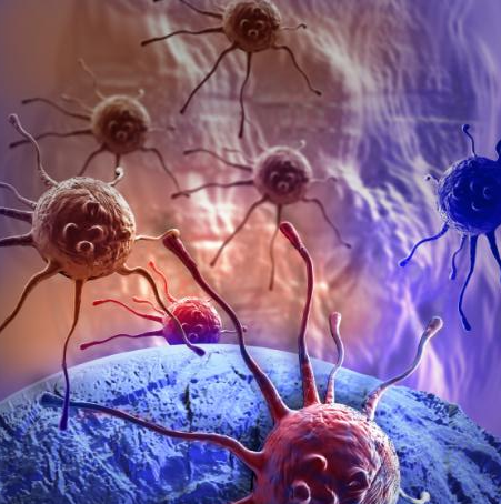 Cancer Clsim Israel and Stuff » Israeli cancer treatment company raises $12m for ...